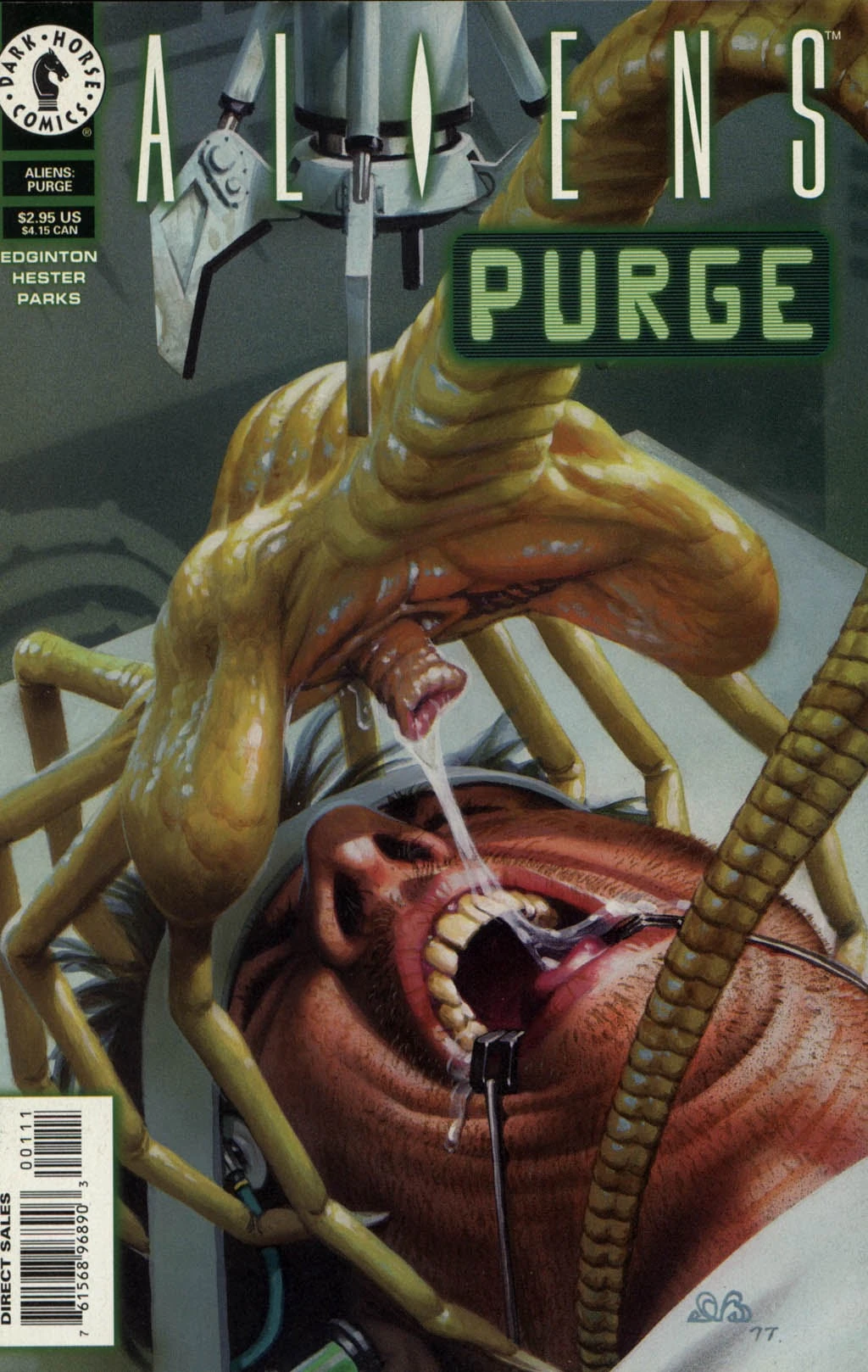 Purge
